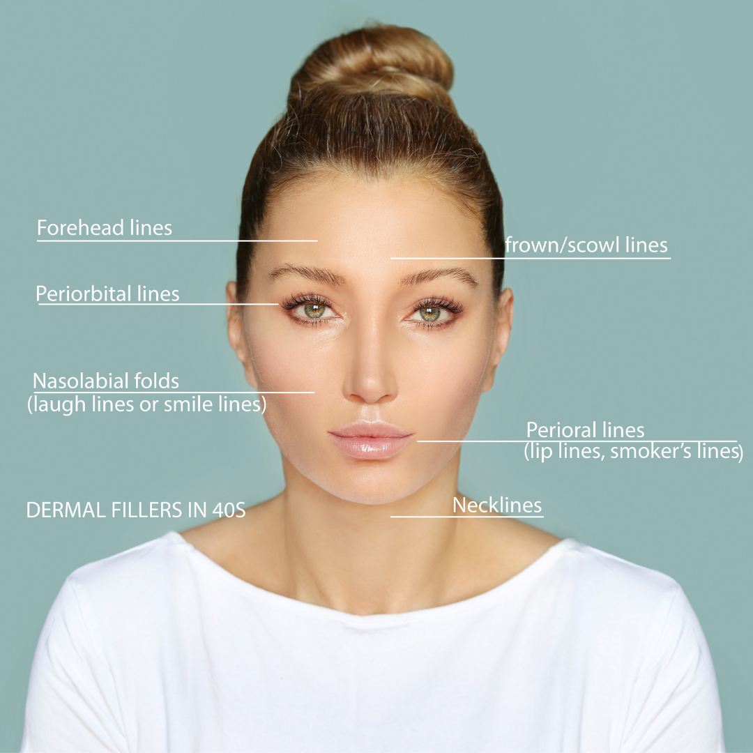 Fillers Treatment Dr. Madhu's Hospital